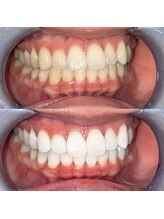 ライトビューティー 池袋店(LightBeauty)/症例写真