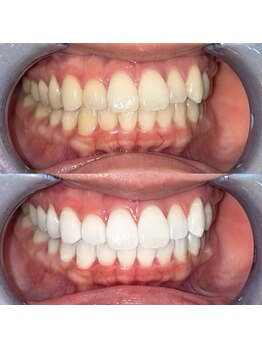 ライトビューティー 池袋店(LightBeauty)/症例写真