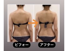 TMサロン 赤坂/もっこり肩解消＆姿勢ケア