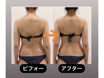 TMサロン 赤坂/もっこり肩解消＆姿勢ケア