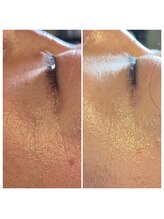 パンダ(Panda)/魔女美鍼