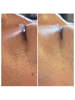 パンダ(Panda)/魔女美鍼