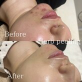 エムフロート(M float)