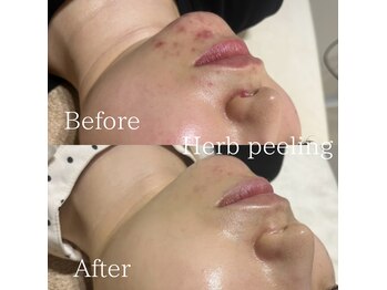 エムフロート(M float)