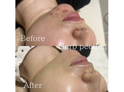 エムフロート(M float)の写真