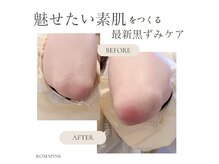 リュミエール デスポワール(Lumiere d'espoir)/ローマピンク