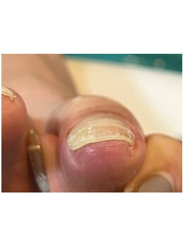 爪の悩みを解消できる（ケア含む）