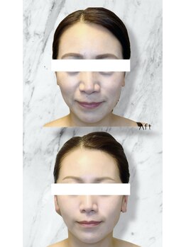 ルミライ(Lumirai)/肌育効果のある内容で美肌へ