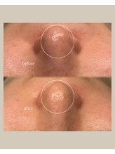 レア(Lea)/月1のメンテナンスに＊