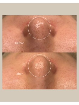 レア(Lea)/月1のメンテナンスに＊