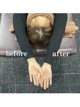 全力ストレッチ 西梅田店/ビフォーアフター1