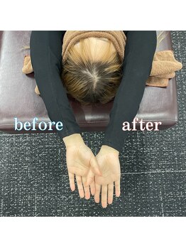 全力ストレッチ 西梅田店/ビフォーアフター1