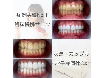 ホワイトニングサロン 名古屋駅店