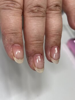 スターチス(STARTICE)/美フォルムベース