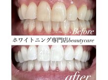 ビューティーケア(beauty care)