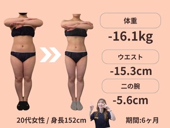 エステティックトレーニングサロン ボディネイト(Body Nate)/Before/After