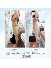 エスプレッソ(espresso,)/【全身痩身】お体の厚み撃退☆