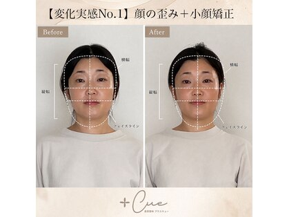 美容整体プラスキュー五反田の写真