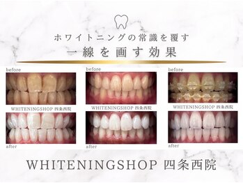 ホワイトニングショップ 四条西院店の写真/【クリアな歯で好印象に！】1回で他の人と差がつく白い歯に！美白効果の高いセルフホワイトニング◎