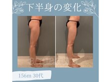 ボディエステティック アクアオーラ 高岡店/下半身の変化