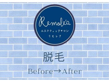 リモレア(RemoLe'a)/