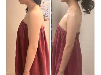 ロココ 豊田店(Rococo)/ビフォーアフター