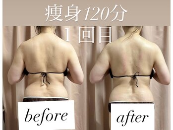 リシェカ(Richeka)/痩身120分