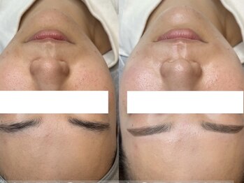 エミュ(e'mu)/フェイスWaxメニューもあります