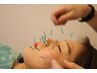 【エイジングケア】美容鍼ベーシック+ヘッドスパ+お顔のスキンケア（約60分）
