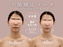 フェリシア(Felicia)の雰囲気（【小顔矯正コルギ】12回でお顔の印象がガラッと変わります♪）