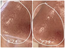 ノーブル シャット Noble Chate/開いた毛穴がキュッと締まる