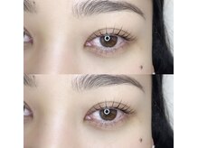 アーラ(ala)/ラッシュリフト