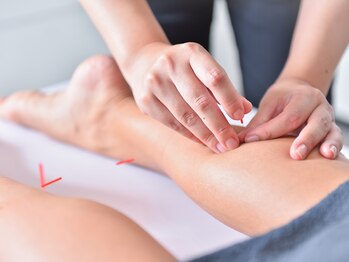 ヤマノ(YAMANO)/からだの美容鍼