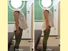 ナオル整体 大宮院(NAORU整体)/反り腰改善！綺麗な姿勢[整体]