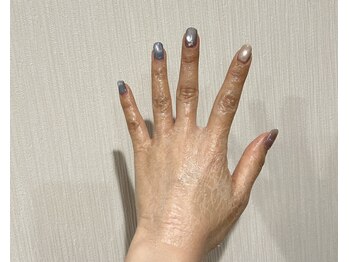 ソフィラ(sophila)/手にパックしてます！