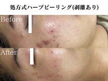 オモテアリ 心斎橋(OmoteAri)
