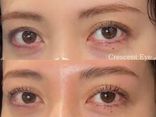 クレセントアイ 吉祥寺(Crescent Eye)/次世代まつげパーマ/マツパ