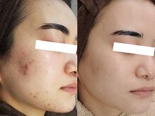 【当店の魅力】結果にこだわり抜くために私たちが大切にしていること