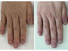 キュアネイル(Qa Nail)/名刺交換に自信が持てた