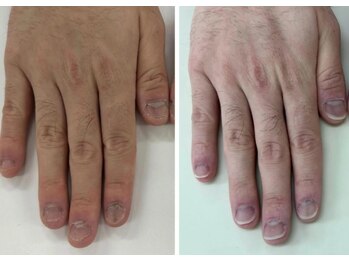 キュアネイル(Qa Nail)/名刺交換に自信が持てた