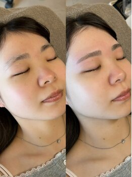 ルポ(repos.)の写真/【黄金比×骨格診断】プロのWAX脱毛で左右差・濃さを解消、翌日からメイクが迷わない似合わせ眉を叶える。