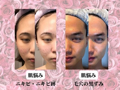 ココ ビューティー ルヴィ(coco beauty REVI)の写真