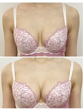 ラビス(RAVIS)/20代☆離れ・形の改善　恵比寿