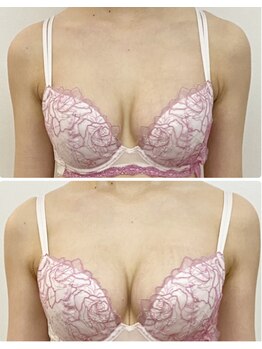 ラビス(RAVIS)/20代☆離れ・形の改善　恵比寿