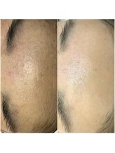 リル バイ ジャックインザボックス(rir by JACK-IN-THE-BOX)/