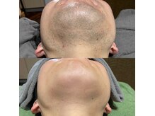 アドーネ カミカゼ(Adone Kamikaze)の雰囲気（日田市ヒゲ脱毛実力No. 1♪最短卒業！！）