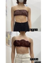 メリアミーゴ(Meli amigo)/20代女性　肩凝り首コリ改善