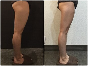 美容整体ウェリナ 名駅院/小顔矯正/骨盤矯正/美脚サロン