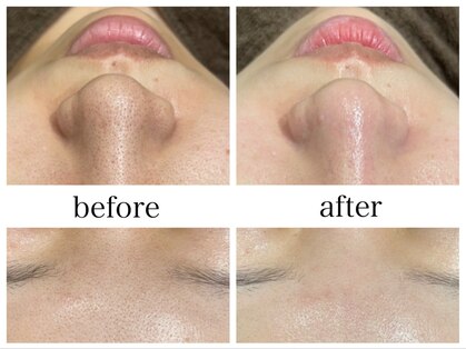 アリエスの写真