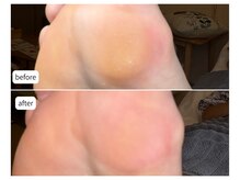 カシェット(Cachette)/40代女性◎足裏角質ケア90分